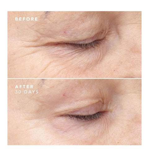 30 Day Power Treatment