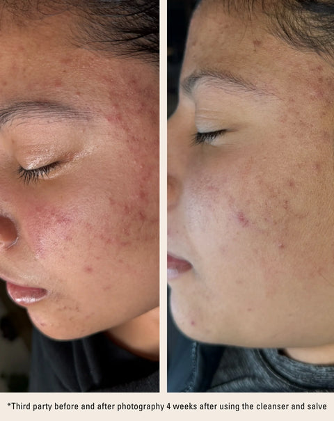 Mānuka Cleanser